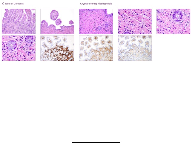 Small Intestinal Pathology screenshot 2 of 6