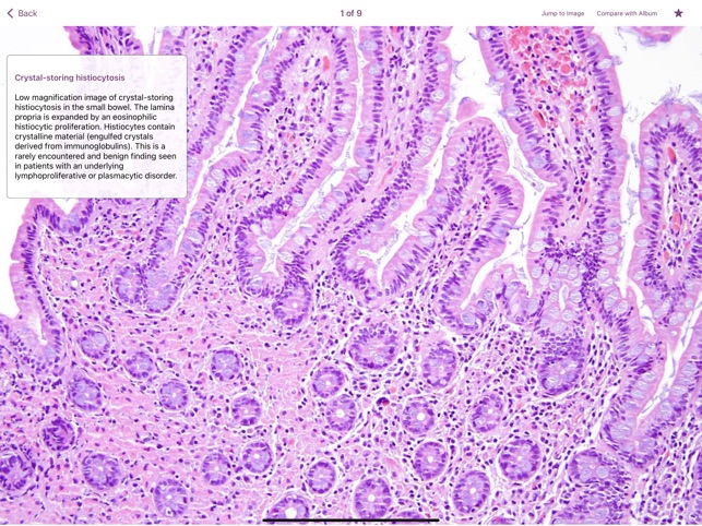 Small Intestinal Pathology screenshot 3 of 6