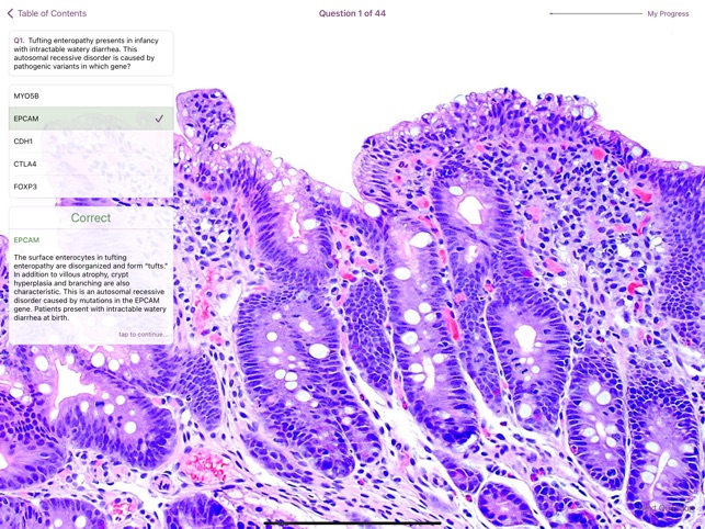 Small Intestinal Pathology screenshot 4 of 6