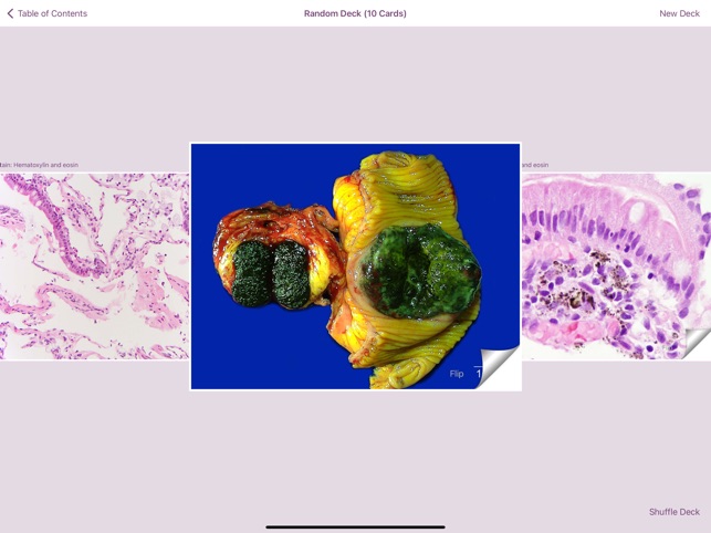 Small Intestinal Pathology screenshot 5 of 6