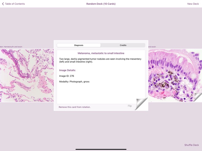Small Intestinal Pathology screenshot 6 of 6