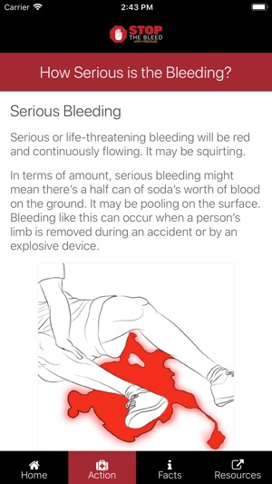 Stop the Bleed screenshot 13 of 26