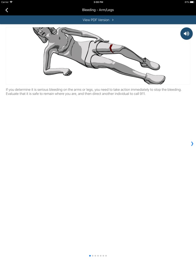 Stop the Bleed screenshot 3 of 26