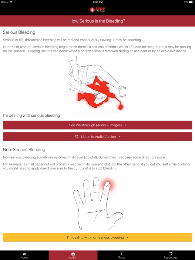 Stop the Bleed screenshot 4 of 26