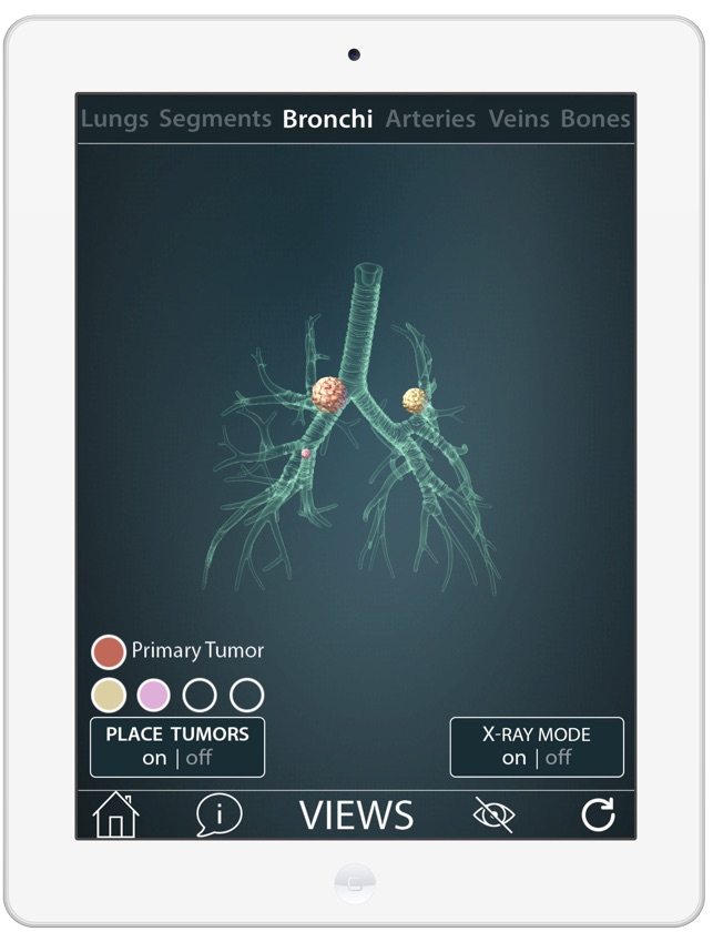 Surgical Anatomy of the Lung screenshot 1 of 8