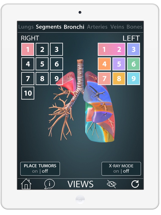 Surgical Anatomy of the Lung screenshot 2 of 8