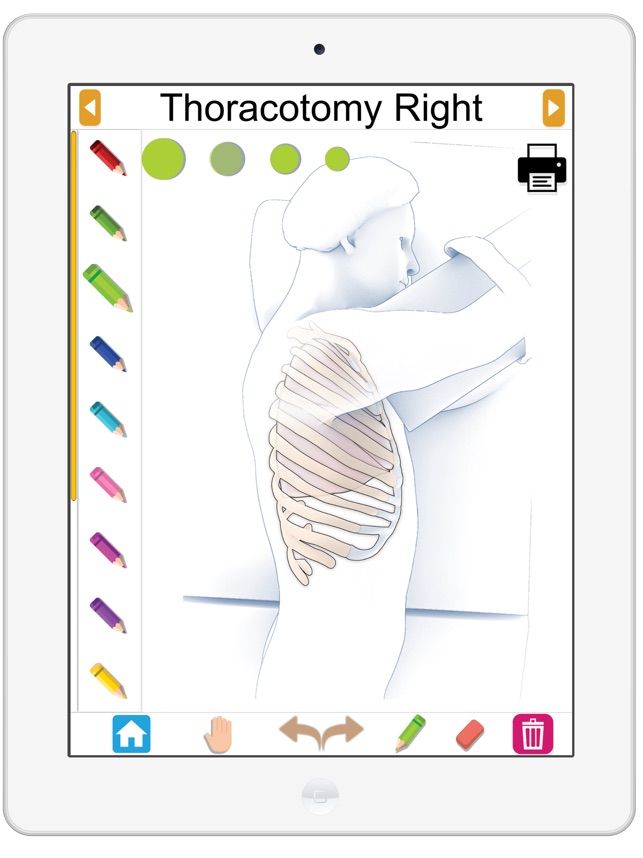 Surgical Anatomy of the Lung screenshot 3 of 8