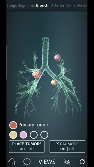 Surgical Anatomy of the Lung screenshot 4 of 8