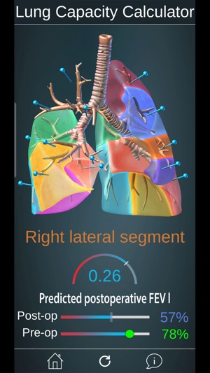 Surgical Anatomy of the Lung screenshot 5 of 8