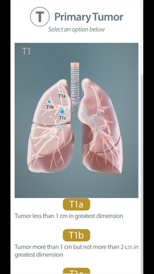 Surgical Anatomy of the Lung screenshot 7 of 8
