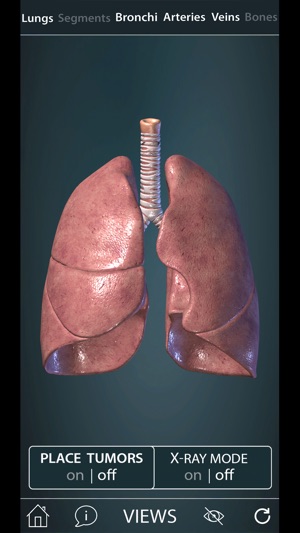 Surgical Anatomy of the Lung screenshot 8 of 8
