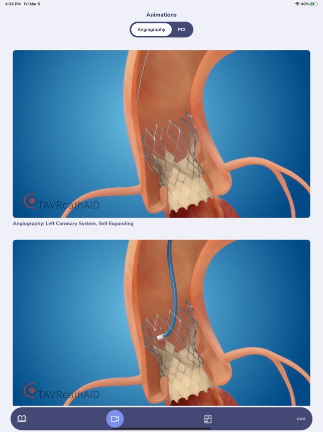 TAVRcathAID screenshot 1 of 10