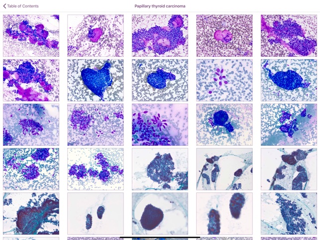 Thyroid Pathology screenshot 2 of 5