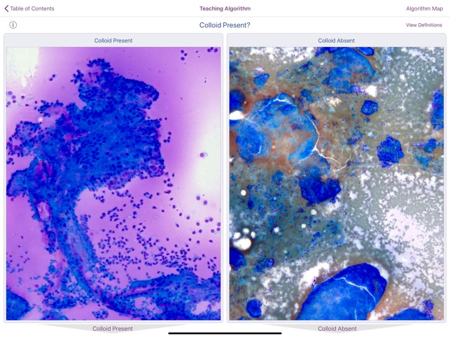 Thyroid Pathology screenshot 3 of 5