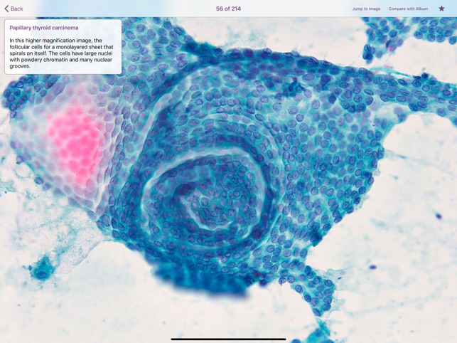 Thyroid Pathology screenshot 4 of 5