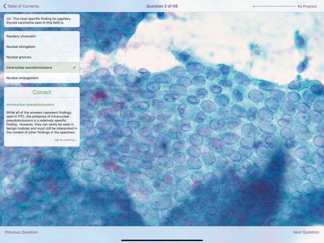 Thyroid Pathology screenshot 5 of 5