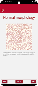 WashU Medicine Easy CBC screenshot 3 of 9