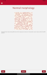 WashU Medicine Easy CBC screenshot 9 of 9